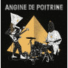 Angine De Poitrine - Angine De Poitrine, Vol. II (CD)